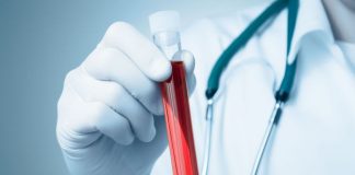 HIV spread at record levels in Korea