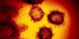 US man, 30, dies from virus after attending ‘Covid party’